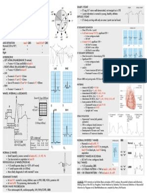 busty mandy ecg|Cardiac electrophysiology and ECG interpretation.